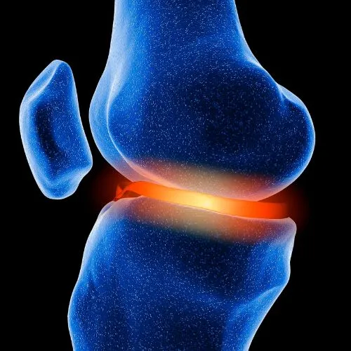 Cartilage Transplantation